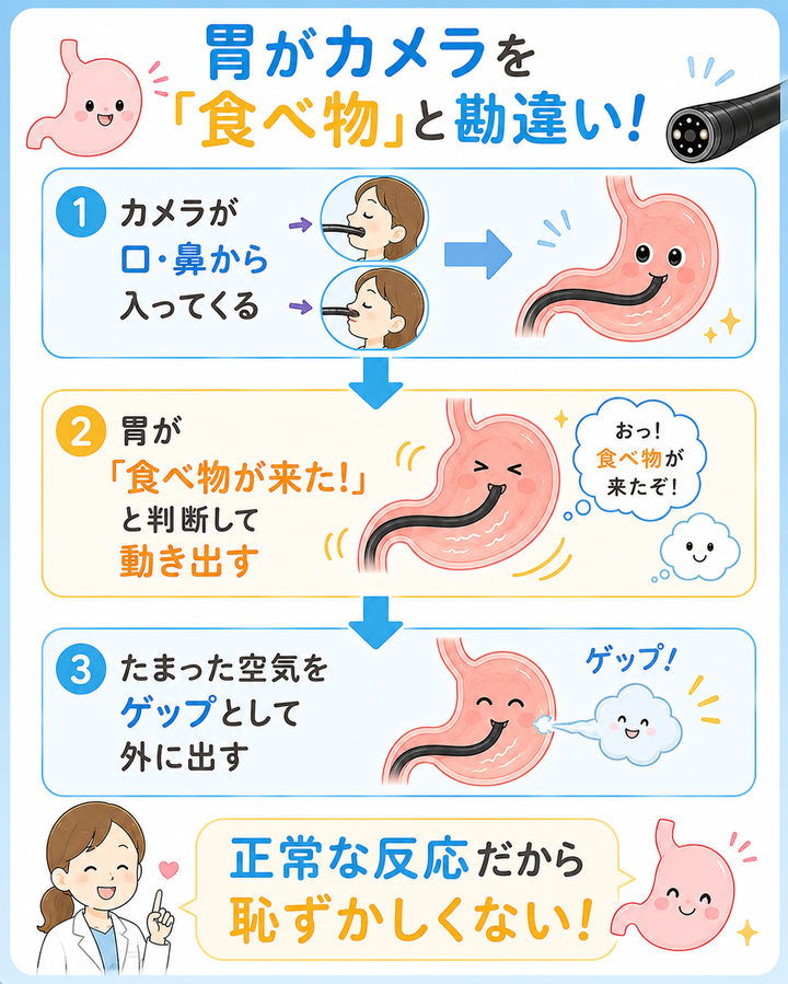 胃がカメラを「食べ物」と勘違い！
