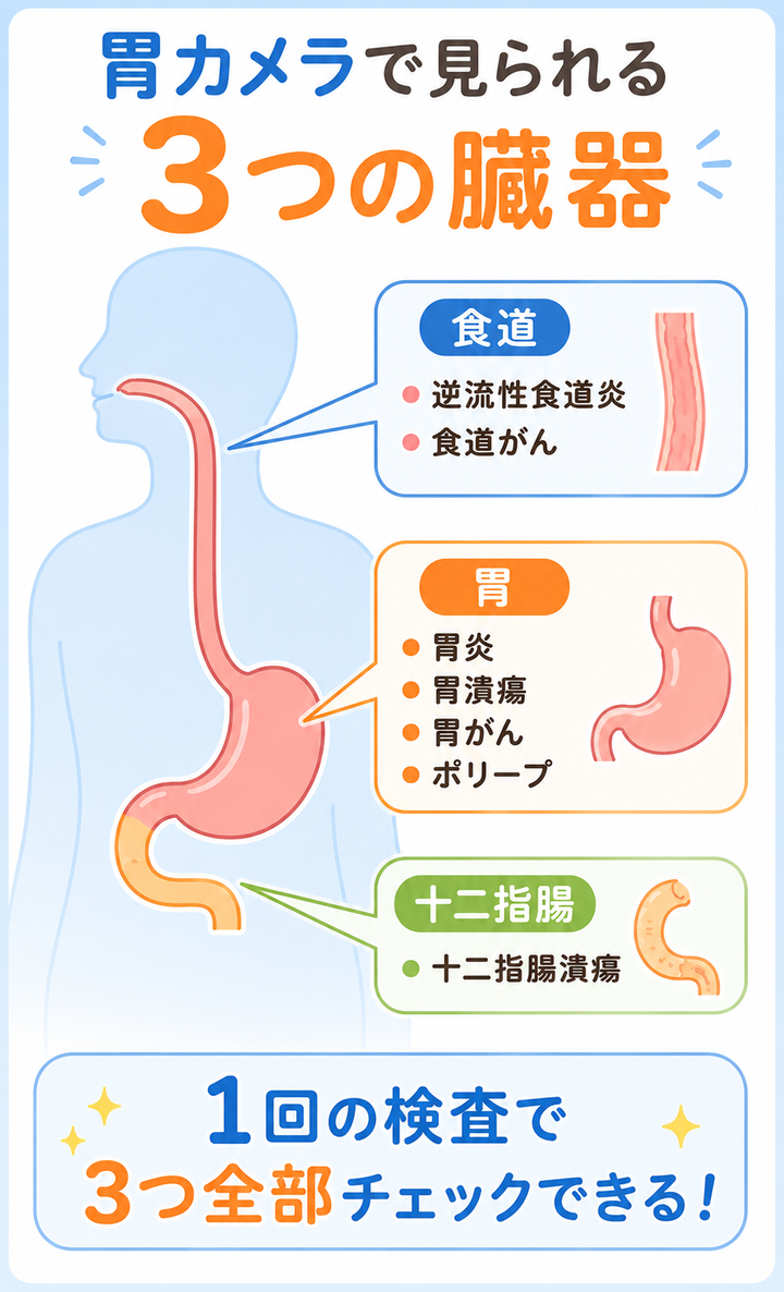 胃カメラで見られる3つの臓器