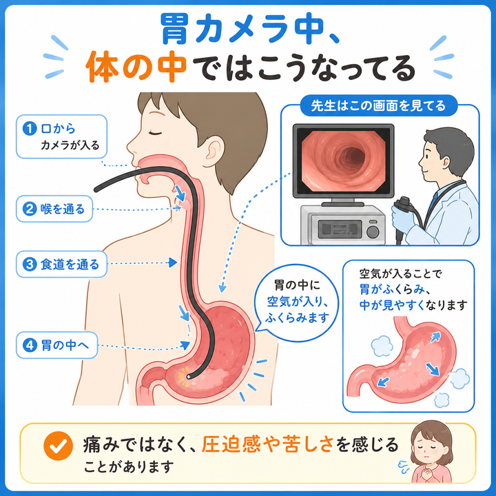 胃カメラ中、体の中ではこうなってる