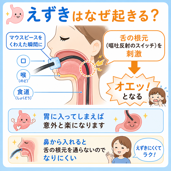 えずきはなぜ起きる?