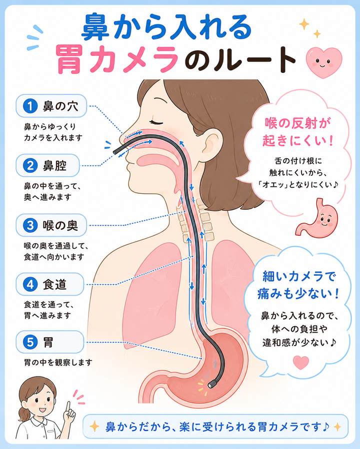 鼻から入れる胃カメラのルート