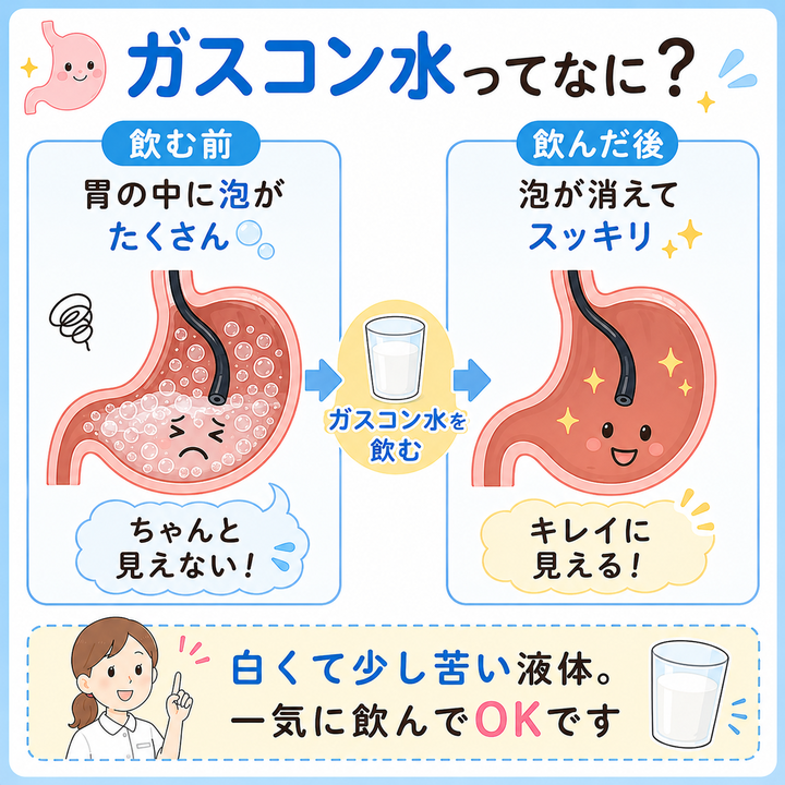 ガスコン水ってなに？