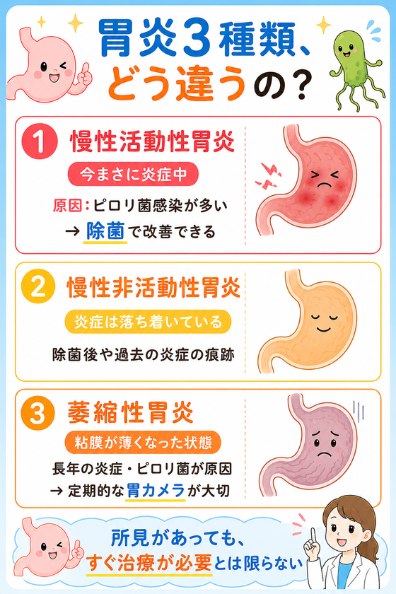 胃炎3種類、どう違うの?