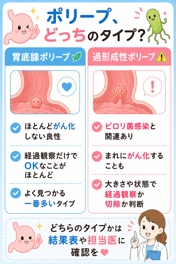 ポリープ、どっちのタイプ?