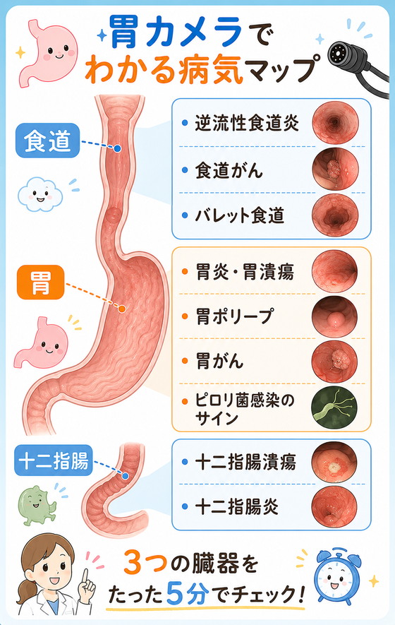 胃カメラでわかる病気マップ