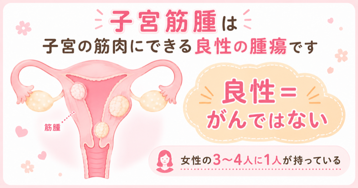 子宮筋腫は子宮の筋肉にできる良性の腫瘍